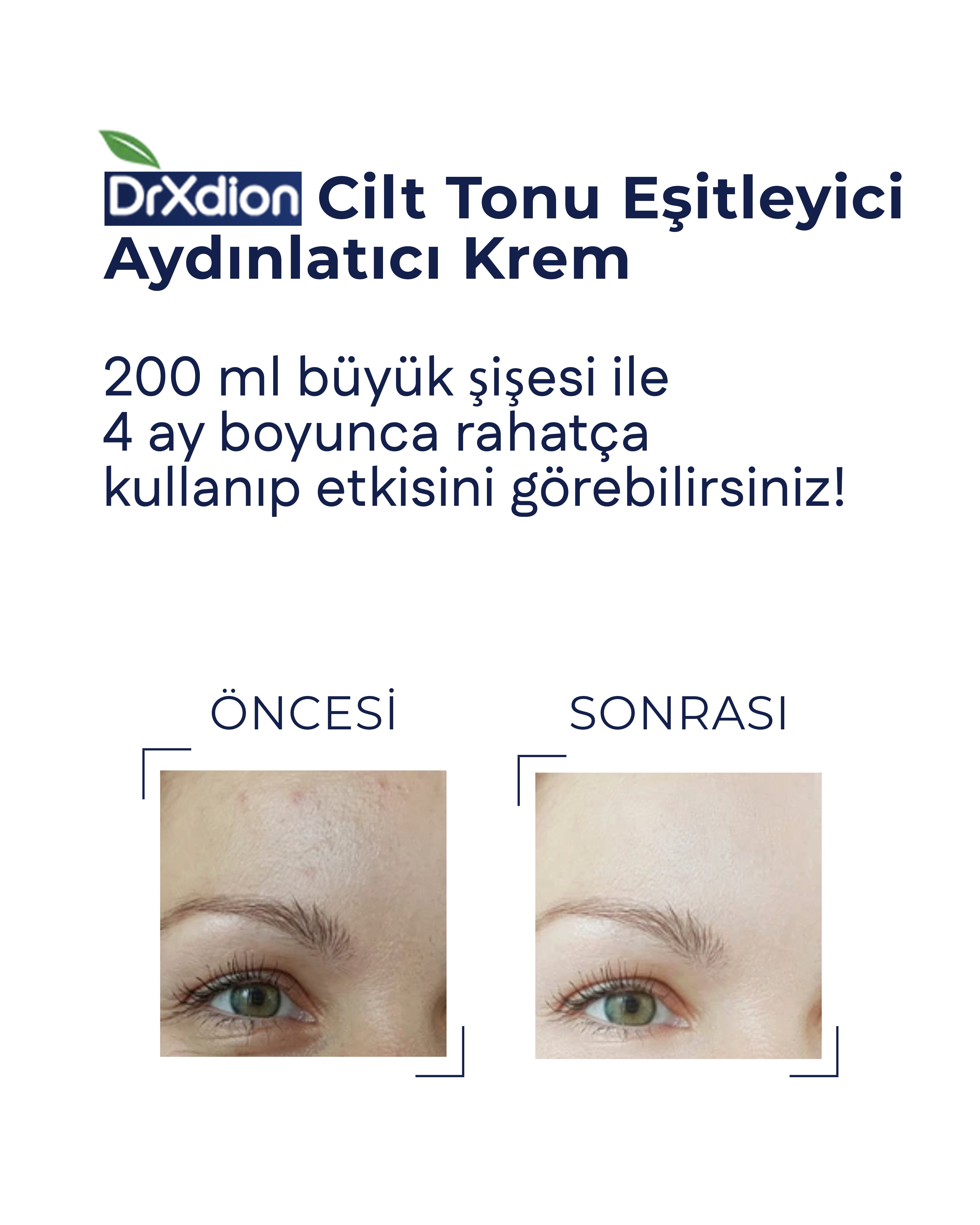 DrXdion Leke Karşıtı Aydınlatıcı Krem Niacinamide, Arbutin Vitamin C, Kojic Asit, Ferulic Asit (200 ml)