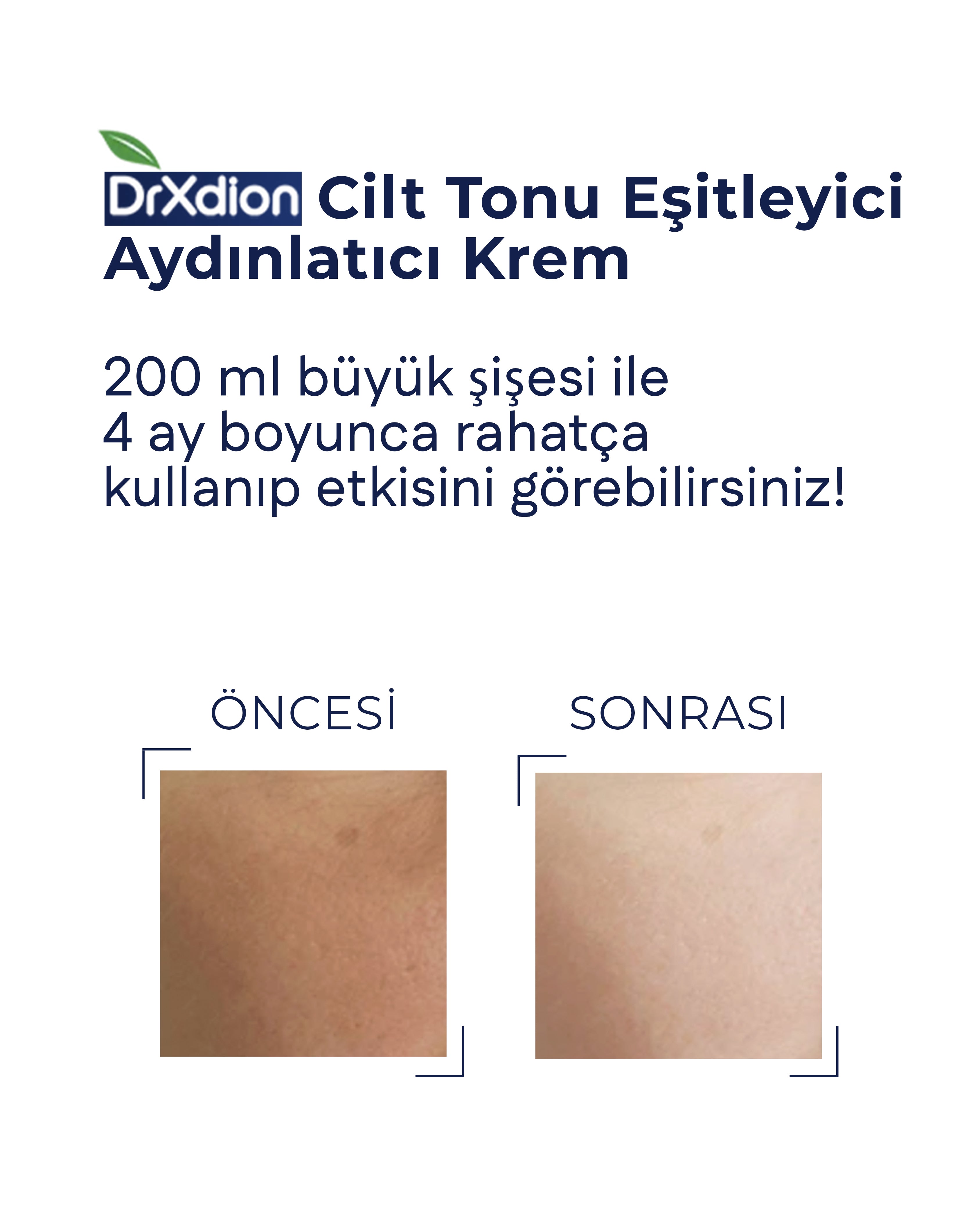 DrXdion Leke Karşıtı Aydınlatıcı Krem Niacinamide, Arbutin Vitamin C, Kojic Asit, Ferulic Asit (200 ml)