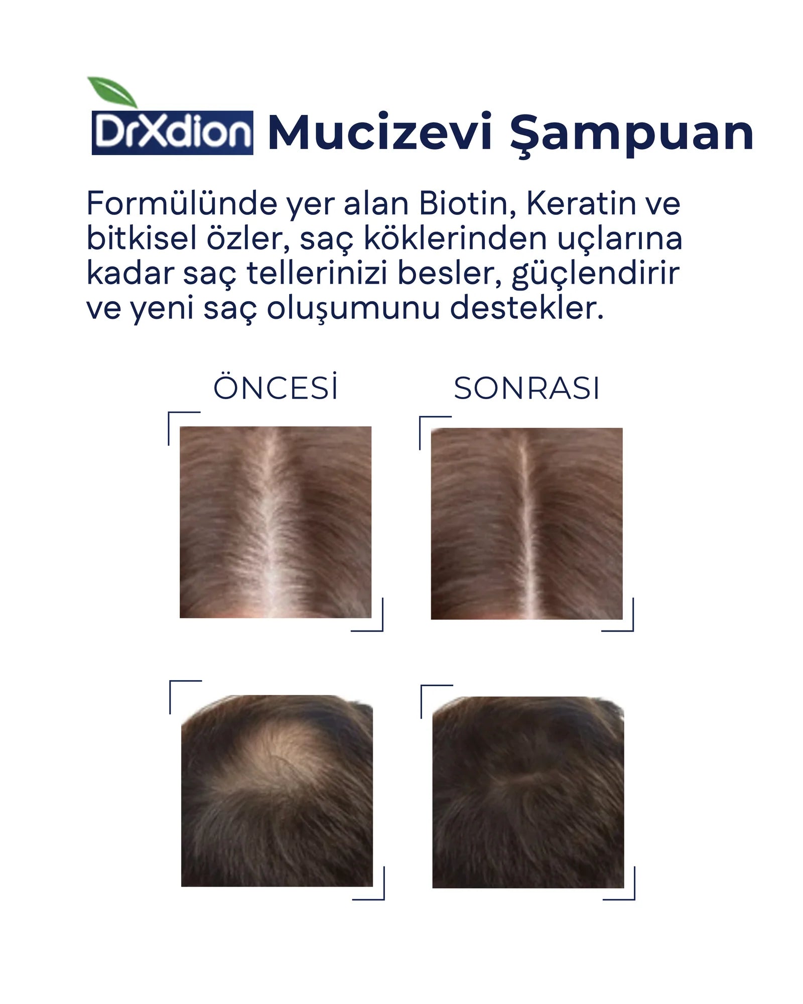 DrXdion Güçlendirici ve Onarıcı Saç Bakım Şampuanı (500 ml)
